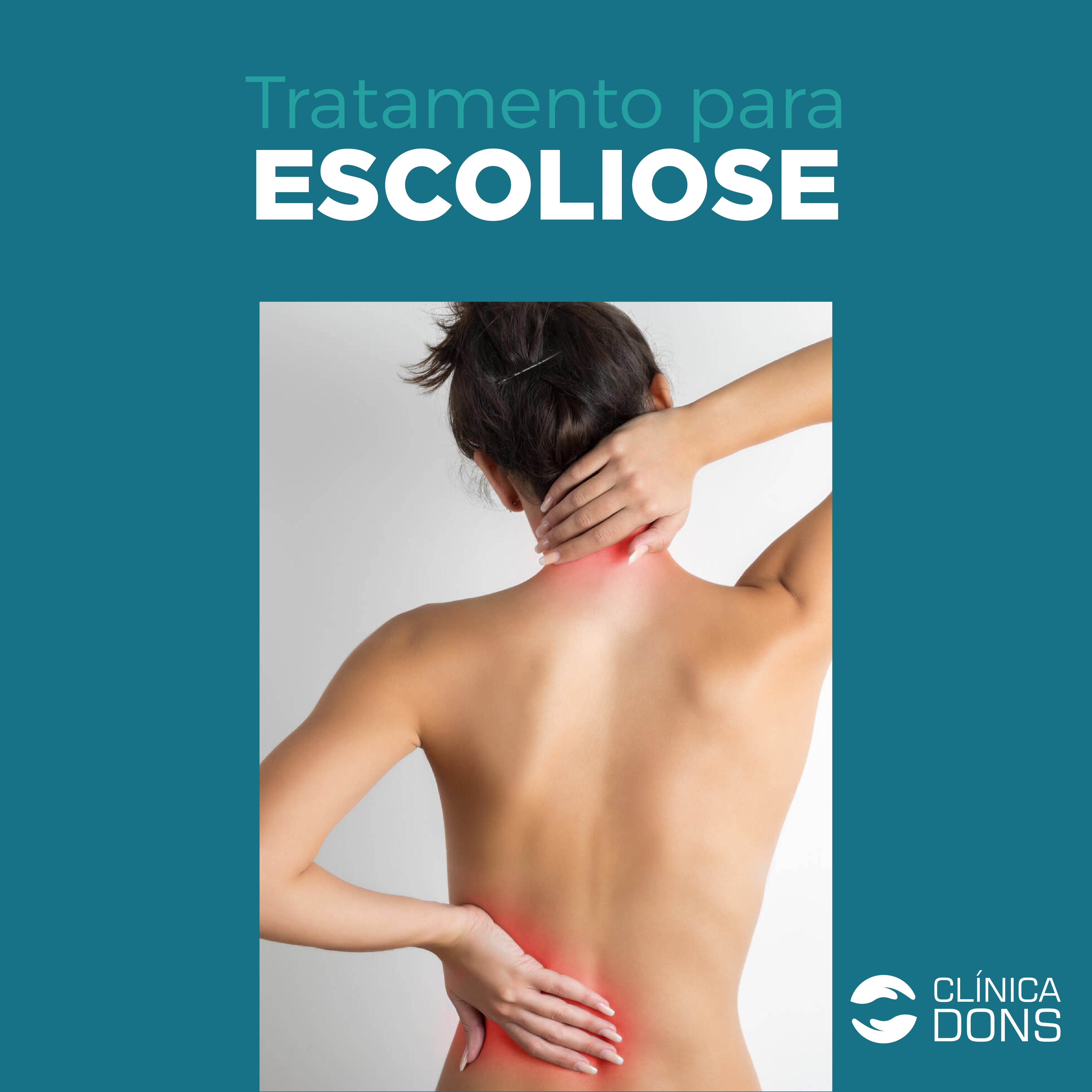 Tratamento para escoliose