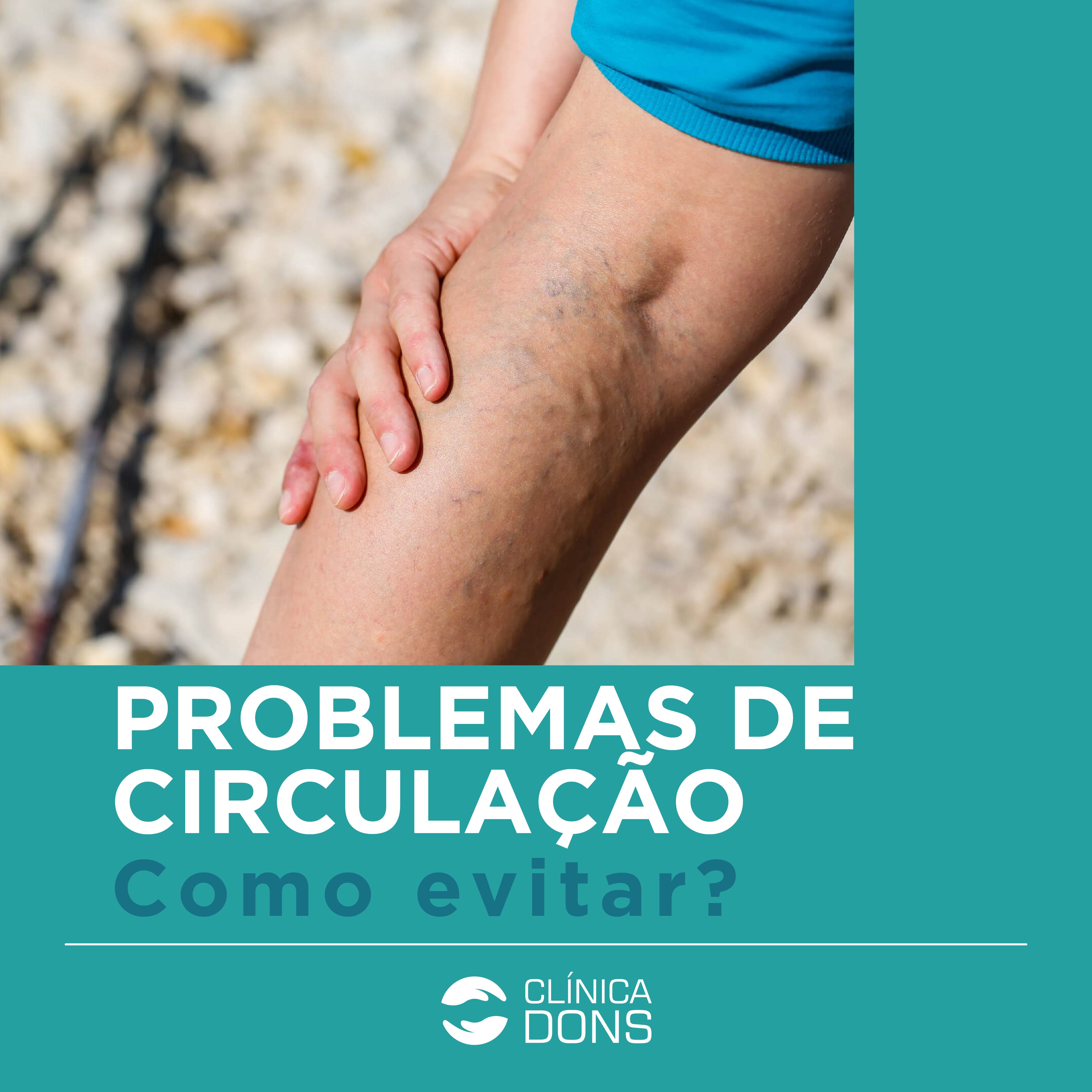 problemas de circulação. Como evitar ?